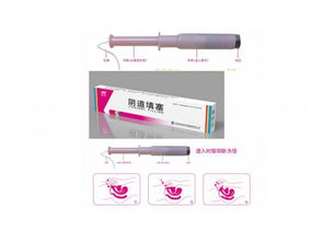 阴道填塞 医保收费妇科耗材