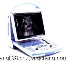 迈瑞DP-10便携式黑白超_医药、保养_世界工厂网